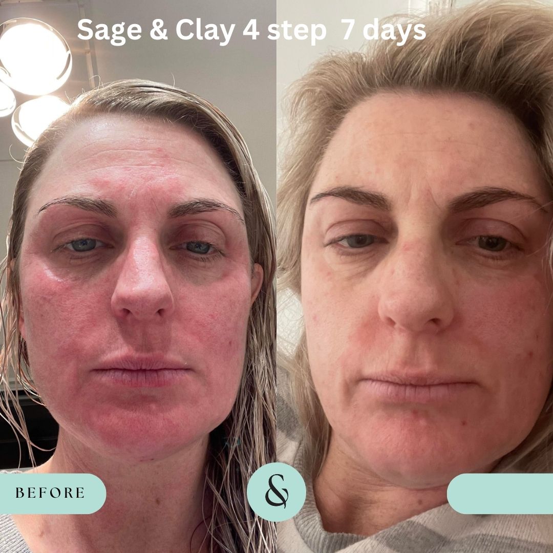 Skin Care Bundle