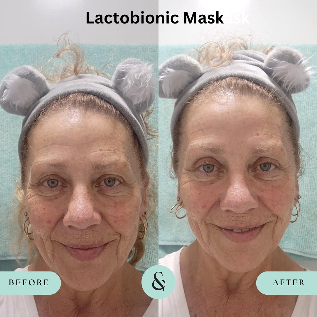 Lactobionic Oat Mask